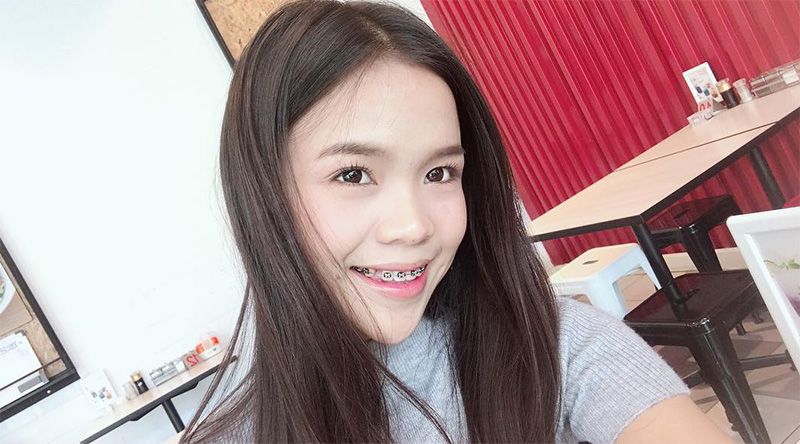 อาม ชุติมา ศัลยกรรม