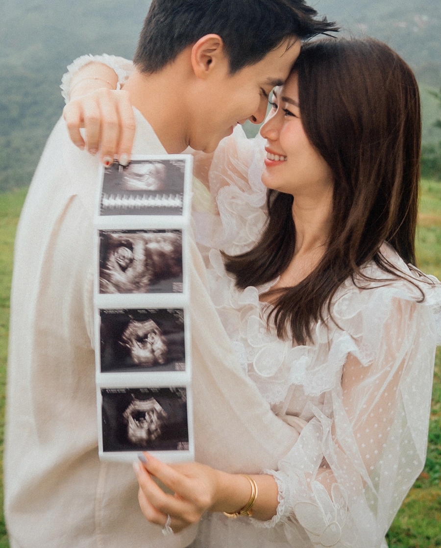 เจมส์ จิรายุ โฟม เบญจมาศ เฉลยเพศลูก