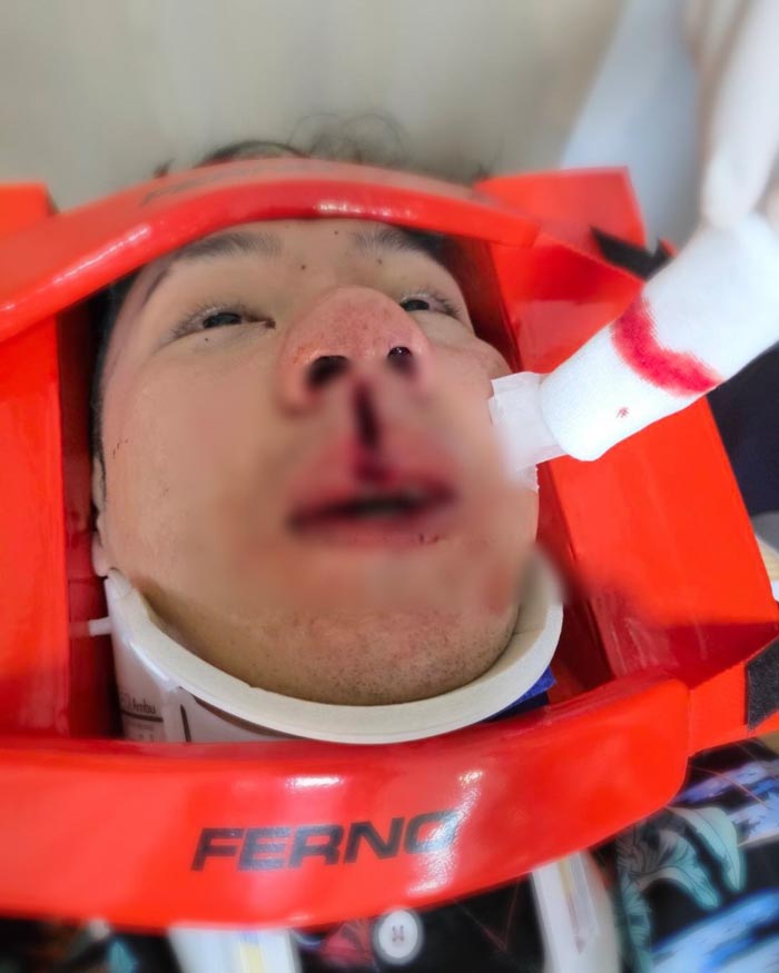 ตั้ม วราวุธ อุบัติเหตุรถชน