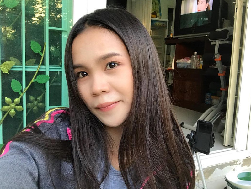 อาม ชุติมา ศัลยกรรม