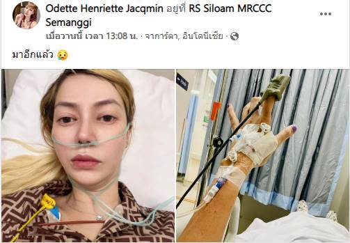 โอเด็ต เล่านาทีเฉียดตาย