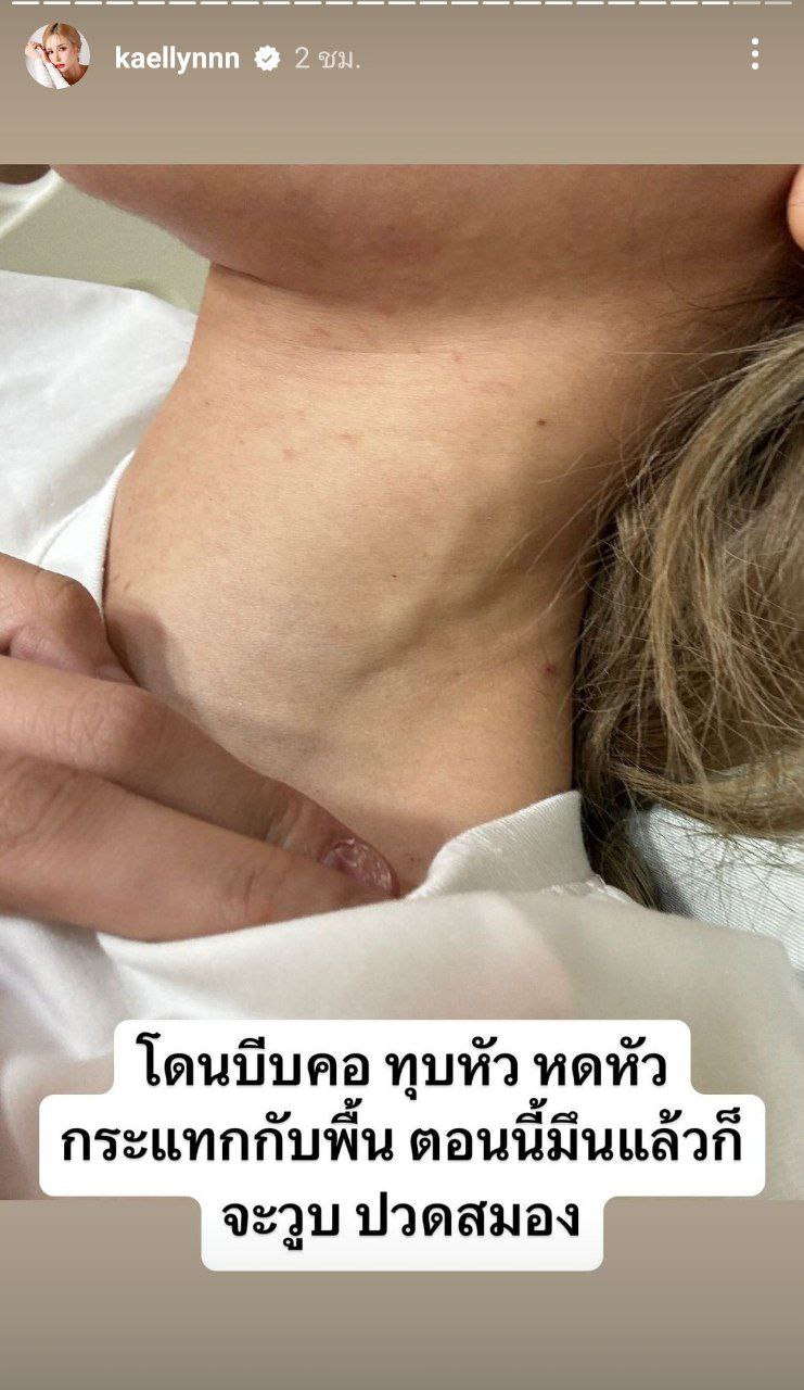 แฟนเก่าทำร้ายร่างกาย