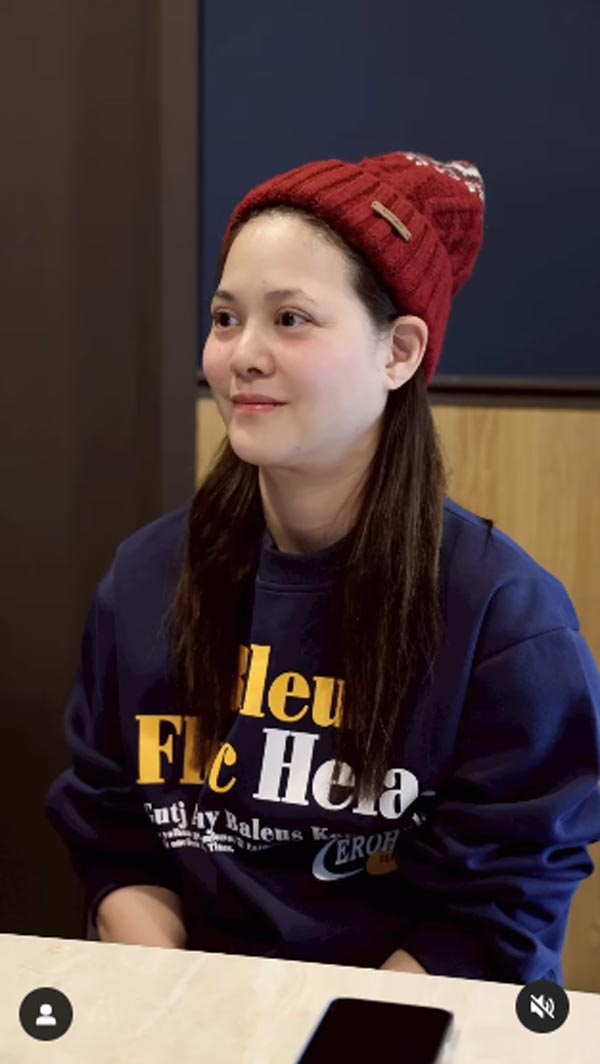 พิมพ์ พิมพ์มาดา ศัลยกรรมยกหน้า