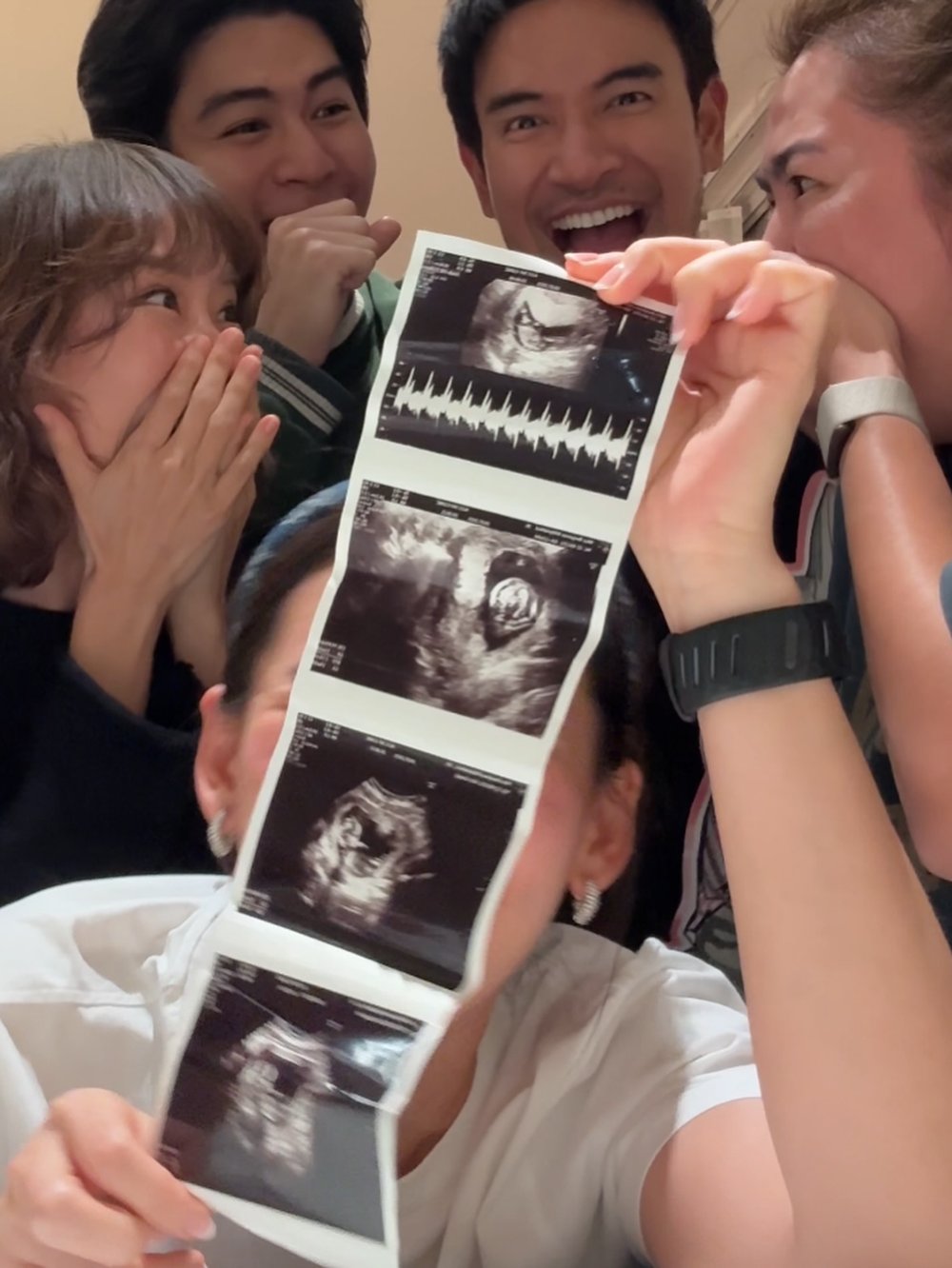 เปิดโมเมนต์ เจมส์จิ-โฟม เซอร์ไพรส์เพื่อน ๆ ด้วยข่าวท้อง แต่มีคนรู้ก่อน