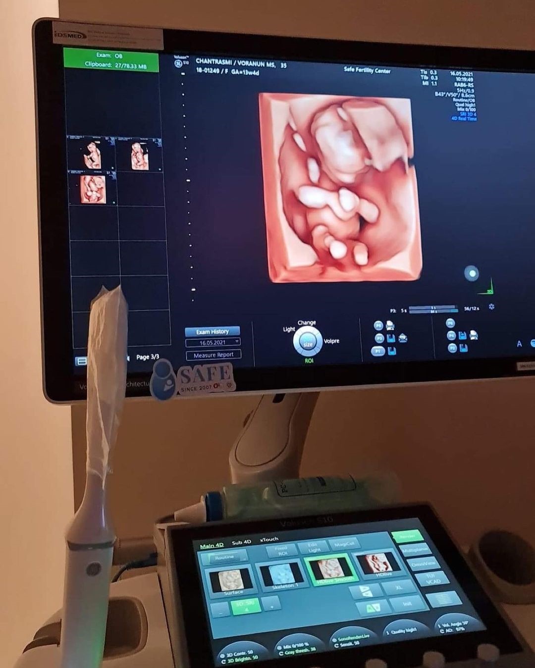 จุ้มจิ้ม วรนันท์ ภัทร