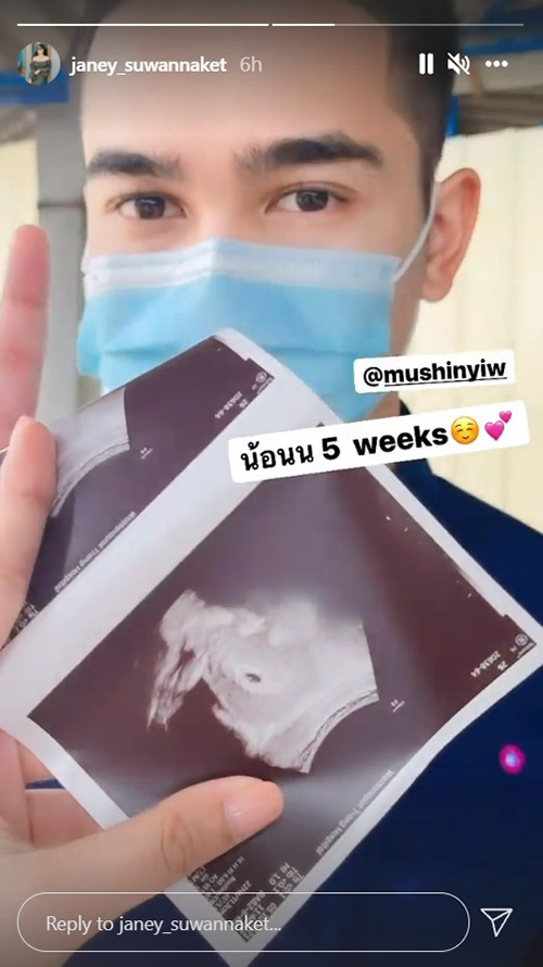 ยิว ฉัตรมงคล