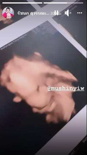 เจนนี่ ยิว  เผยภาพอัลตราซาวด์ลูกสาว