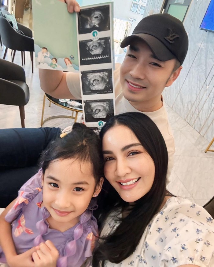 เจมส์ เรืองศักดิ์ ประกาศข่าวดี ครูก้อย ท้องลูกคนที่ 2 