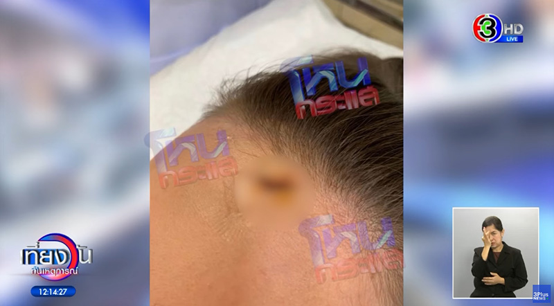 หนุ่ม กรรชัย เฉลยแล้ว ใครเป็นคนกลางแชตหา ดิว อริสรา