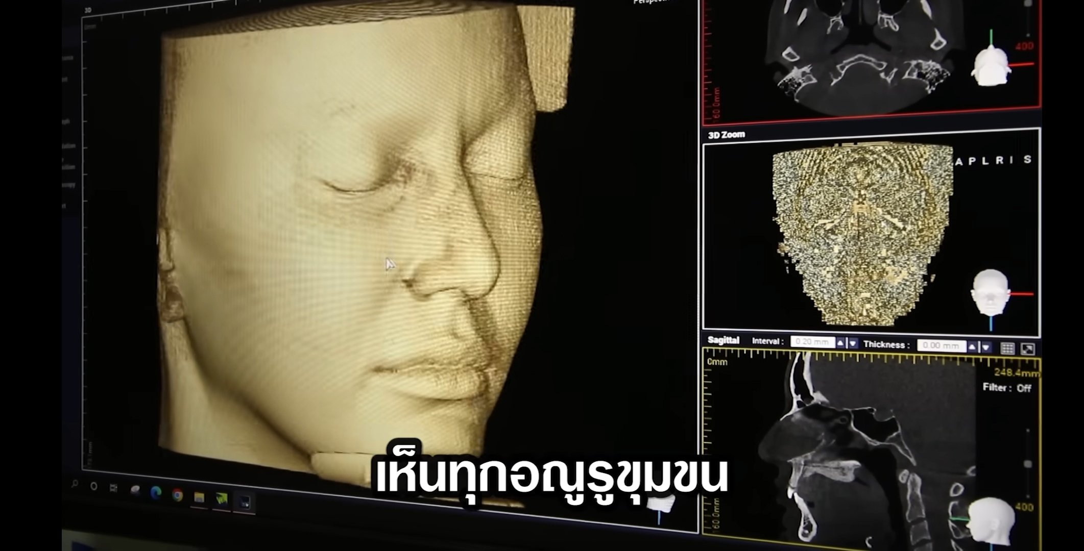 ใหม่ ดาวิกา