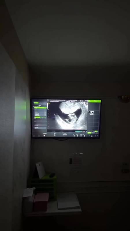 แพท ณปภา ตั้งท้องลูกคนที่สอง