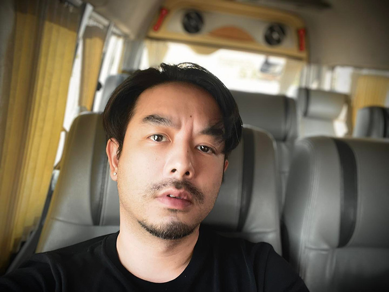 กวาง AB Normal