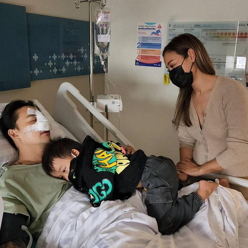 แทค ภรัณยู จมูกหัก