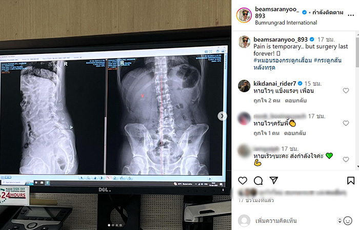 บีม ศรัณยู