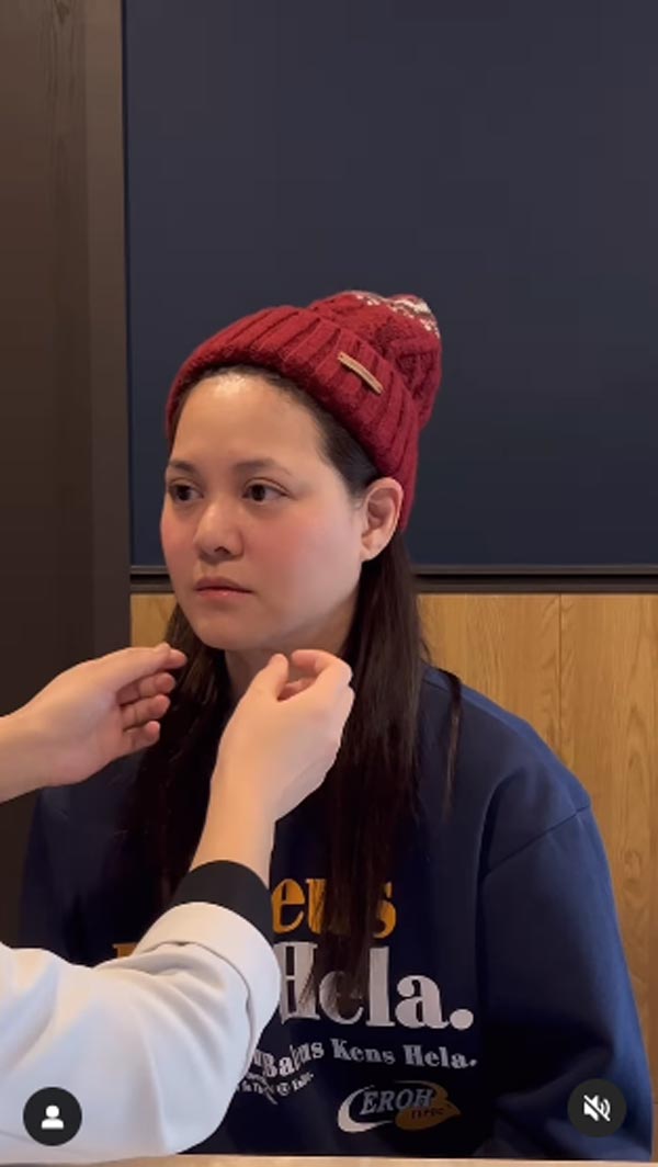 พิมพ์ พิมพ์มาดา ศัลยกรรมยกหน้า