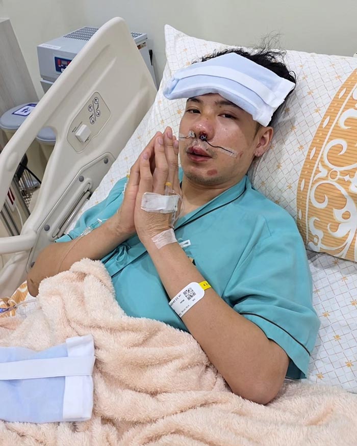 อัปเดตอาการ ตั้ม วราวุธ