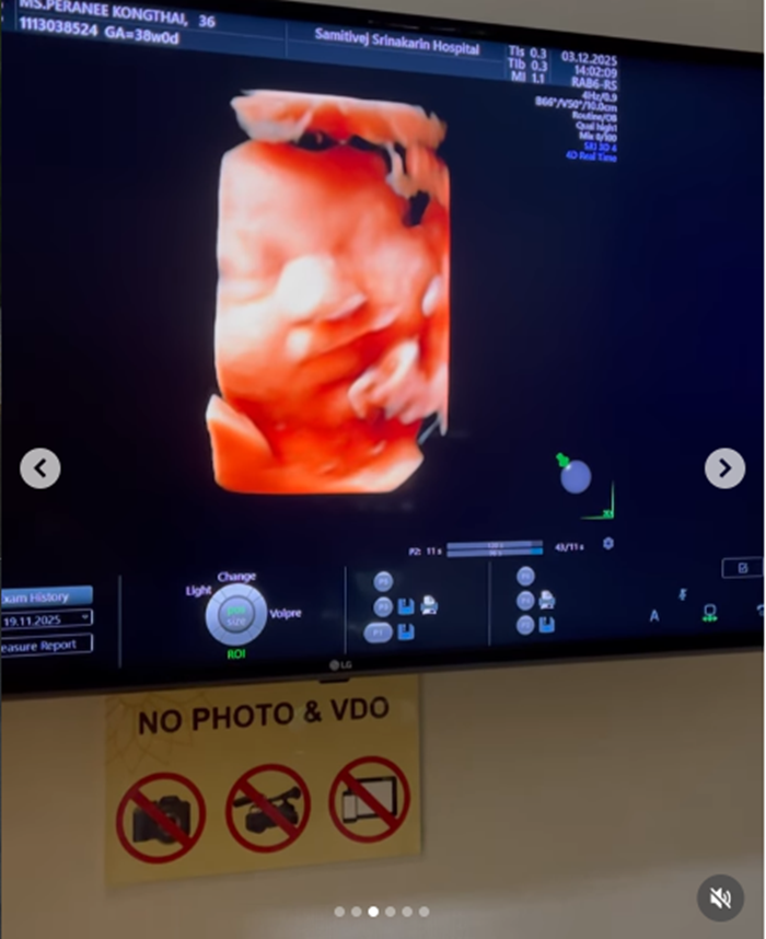  แมท ภีรนีย์ เปิดภาพคุณยายเตรียมทองรับขวัญหลาน