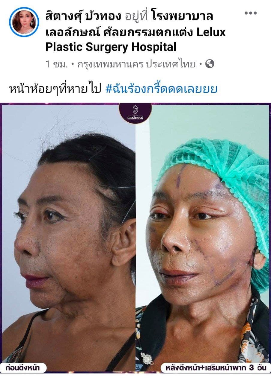 สิตางศุ์ บัวทอง