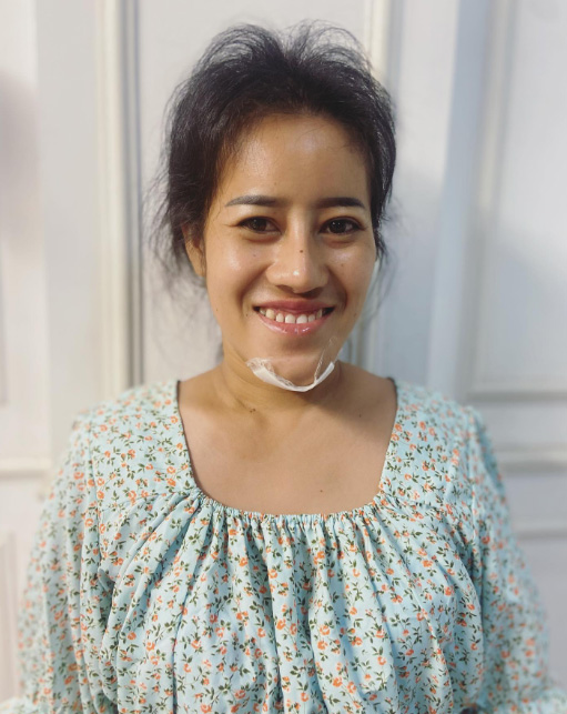 หนูรัตน์ ศัลยกรรม