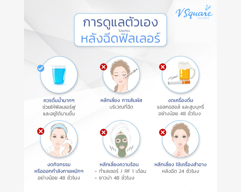 การดูแลหลังฉีดฟิลเลอร์ Neuramis