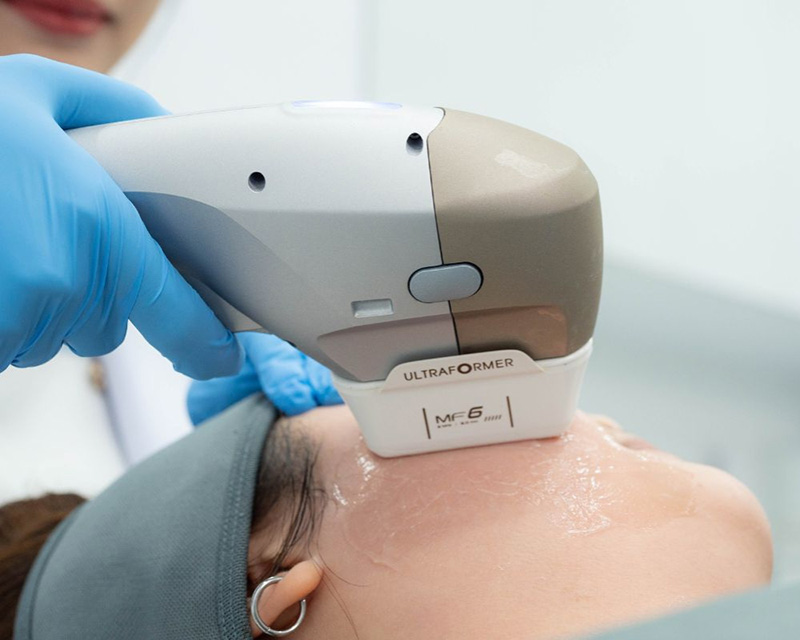 HIFU ที่ไหนดี ทำโดยแพทย์