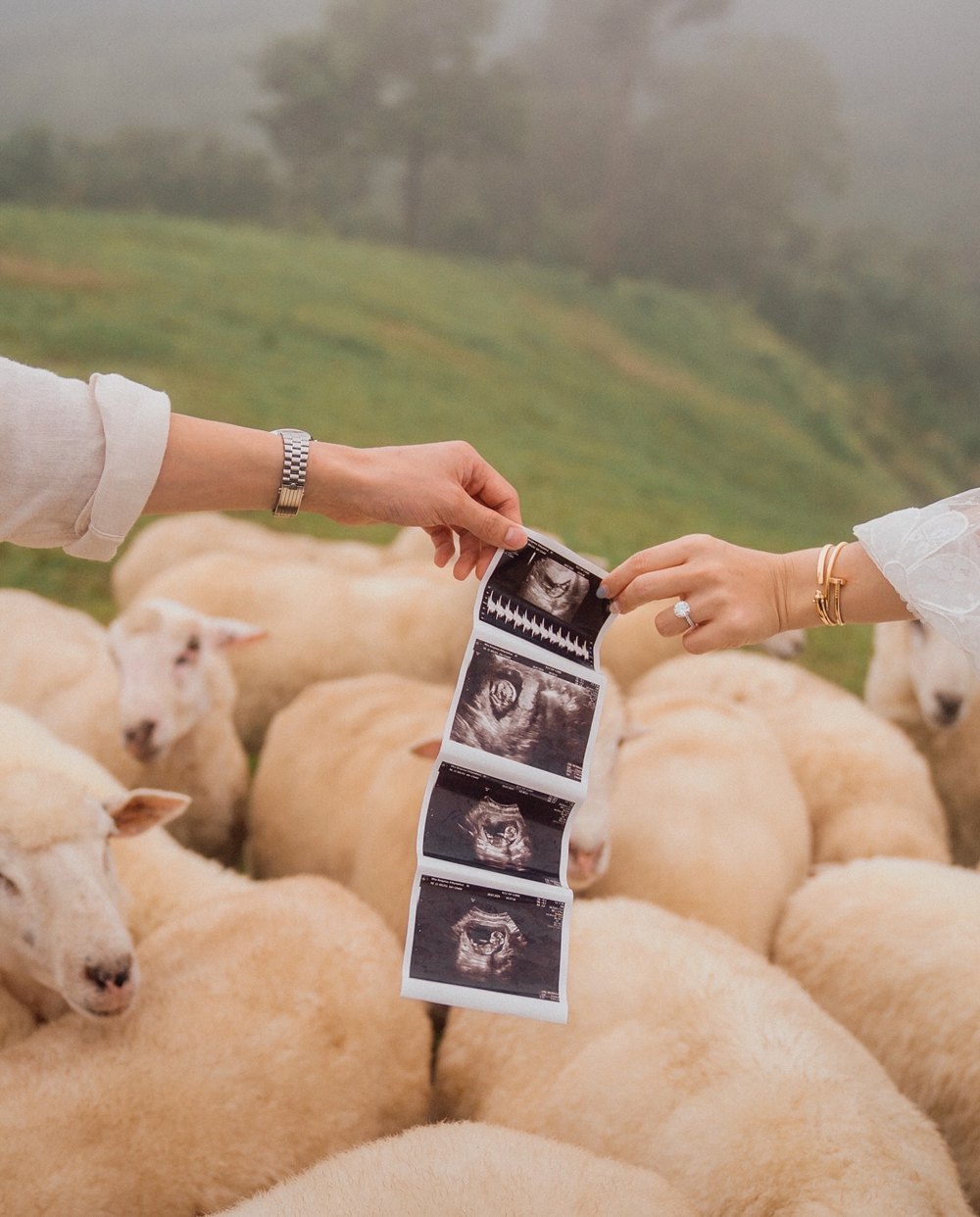 เจมส์ จิรายุ อวดภาพอัลตราซาวด์ ประกาศข่าวดีรับวันแม่ ภรรยาท้องแล้ว