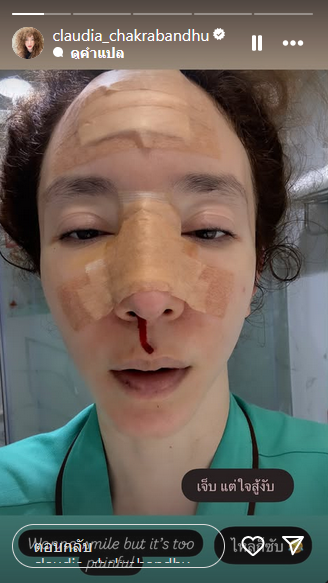 คลาวเดีย จักรพันธุ์