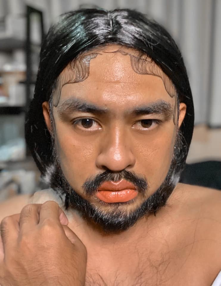 ไรผมทิพย์