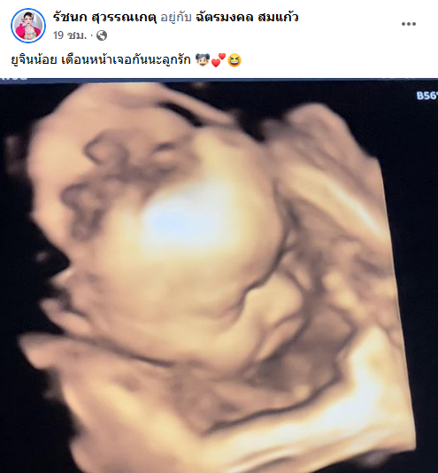 เจนนี่ ยิว  เผยภาพอัลตราซาวด์ลูกสาว