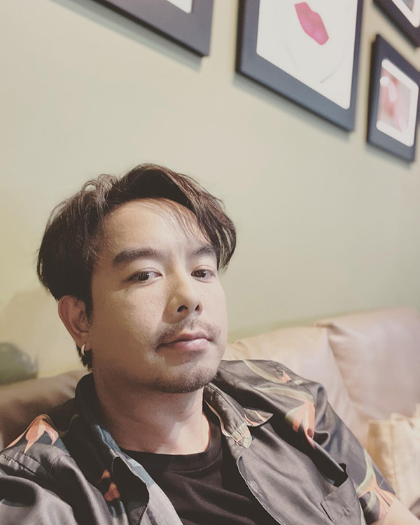 กวาง AB Normal