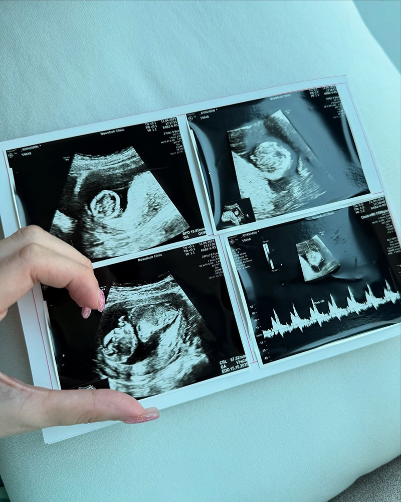 บีเบล ยูทูบเบอร์ล้านซับ ประกาศเป็นแม่เลี้ยงเดี่ยว