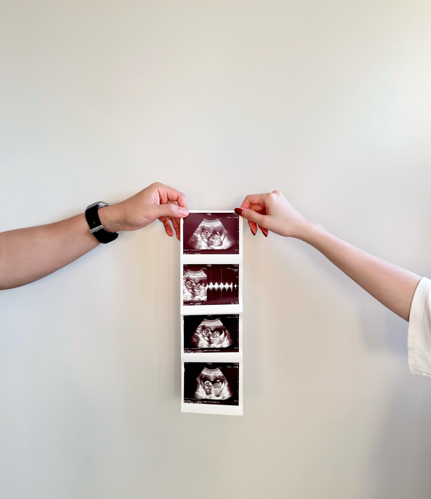 พริม พริมา