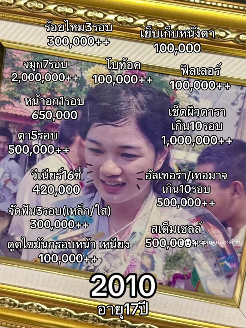 กวาง วรรณปิยะ ศัลยกรรม