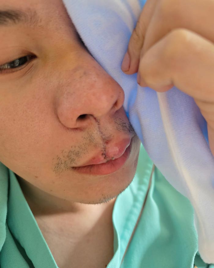 อัปเดตอาการ ตั้ม วราวุธ