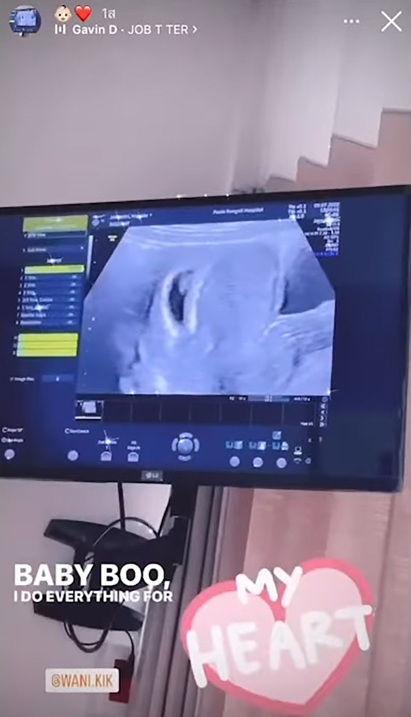 ลูก โหงวเฮ้ง