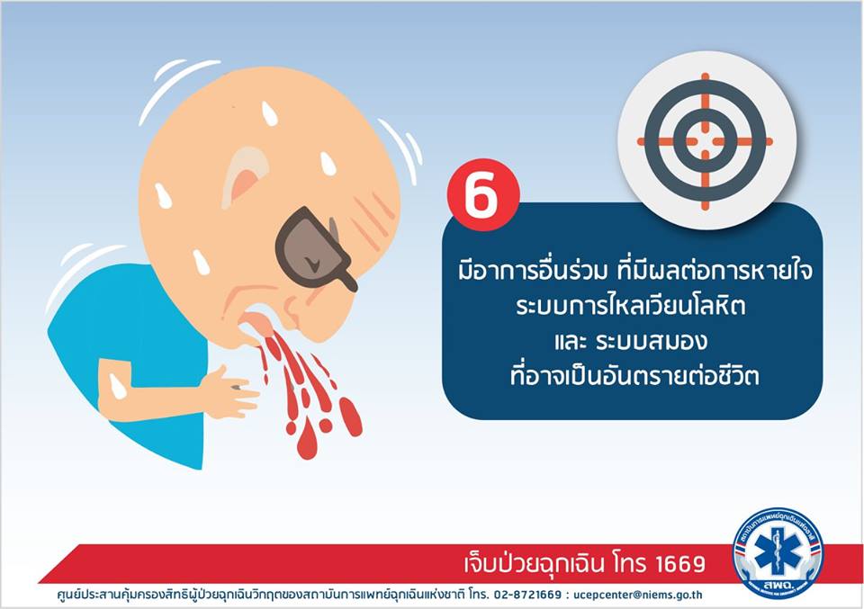 สิทธิ UCEP