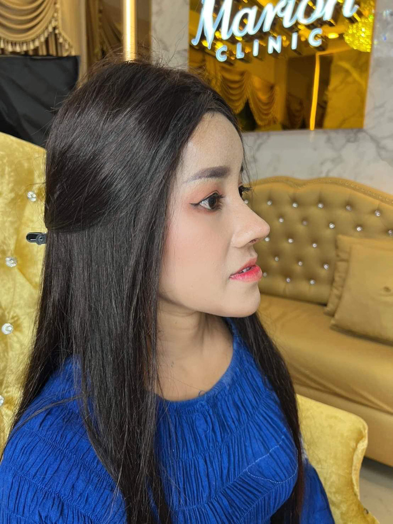  หนูรัตน์ 