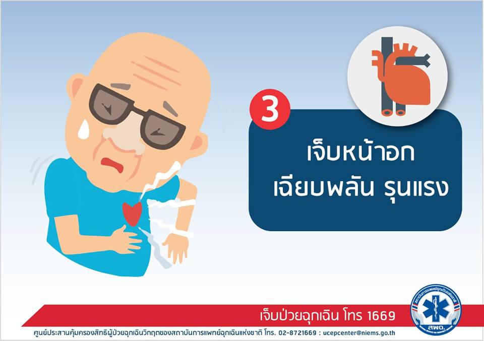 สิทธิ UCEP