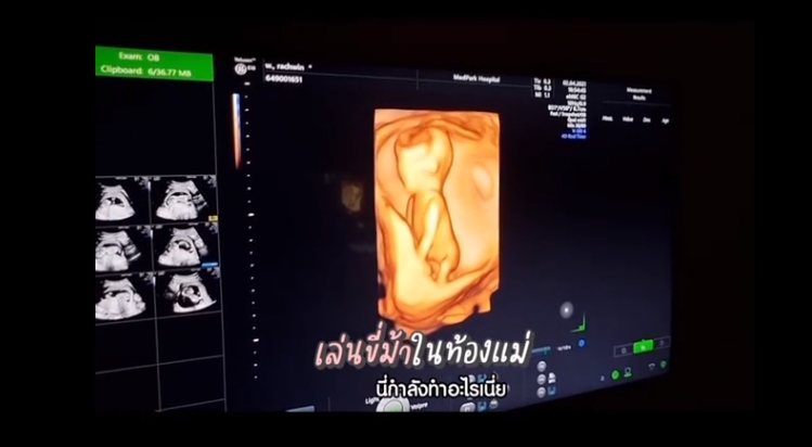  ตูน บอดี้สแลม ก้อย รัชวิน