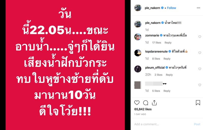 เปิ้ล นาคร
