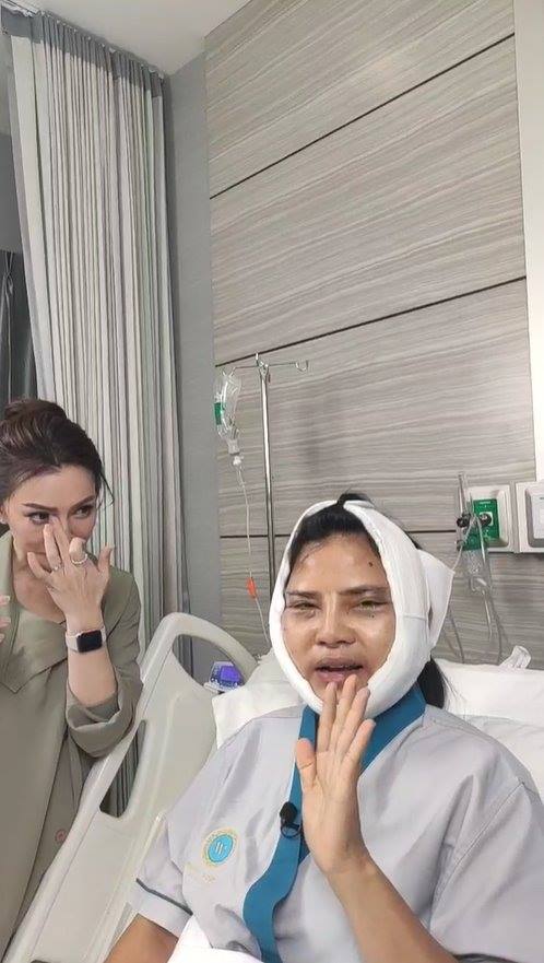 สุนารี ศัลยกรรมหน้า