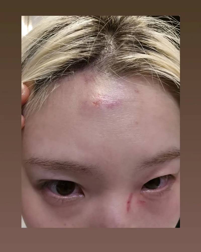 ชเวฮยอนจอง วง Rolling Quartz