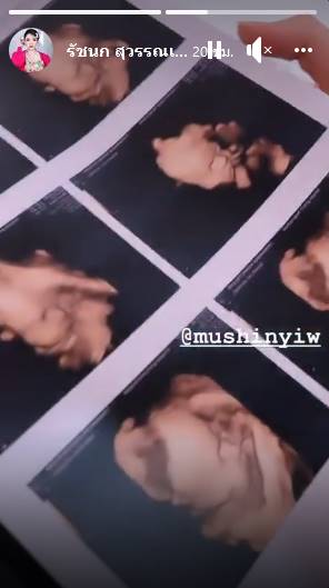 เจนนี่ ยิว  เผยภาพอัลตราซาวด์ลูกสาว