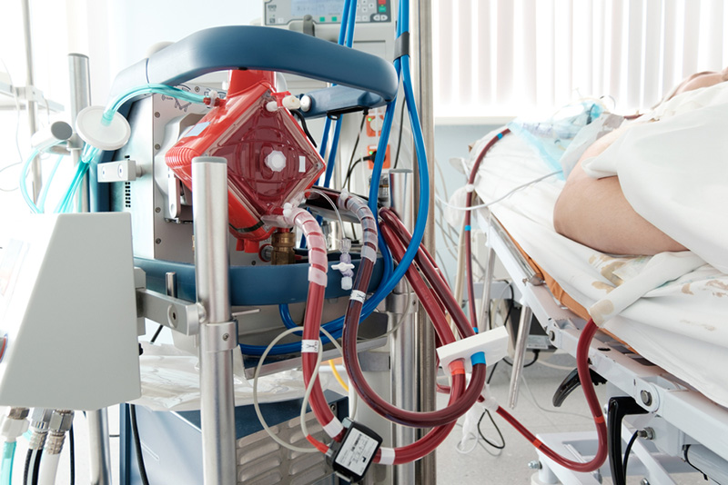 ECMO