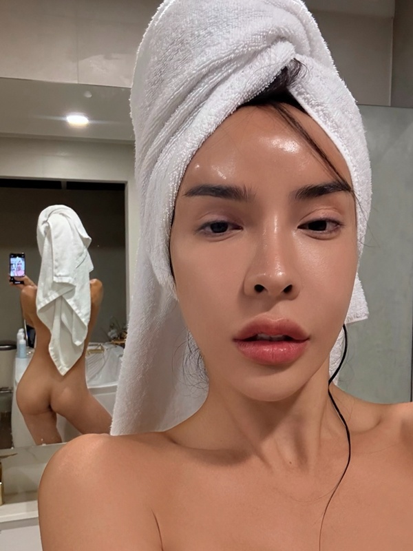 นัท นิสามณี เปิดหน้าล่าสุดหลังผ่าตัด