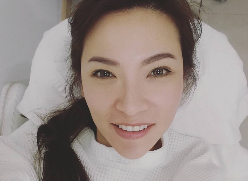 ต้นหอม ศกุนตลา ดาราศัลยกรรม