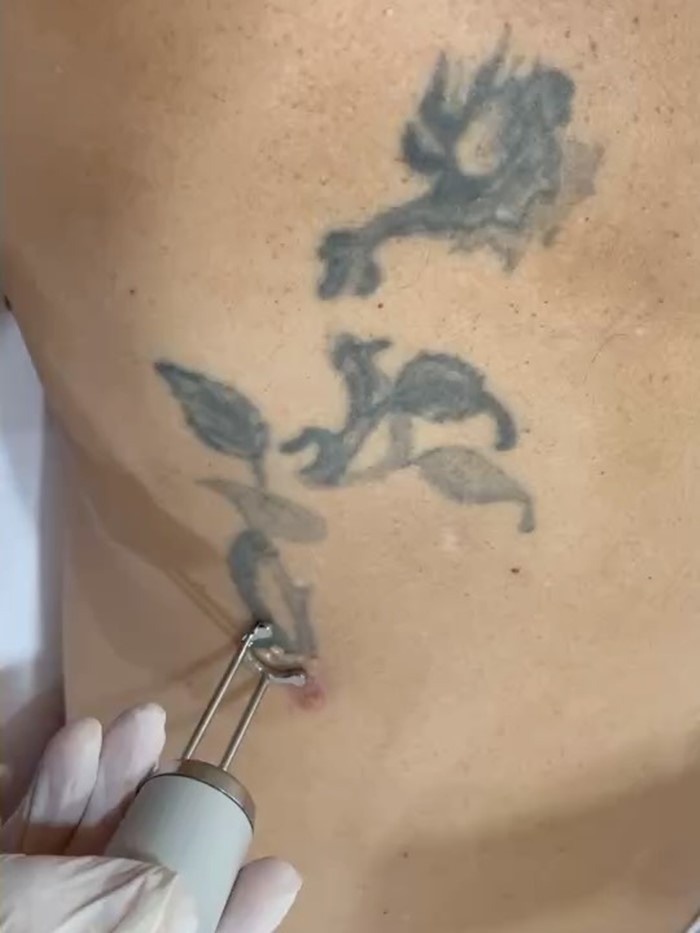 อั๋น โอลิเวอร์ 