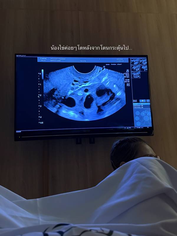 มายด์ ณภศศิ