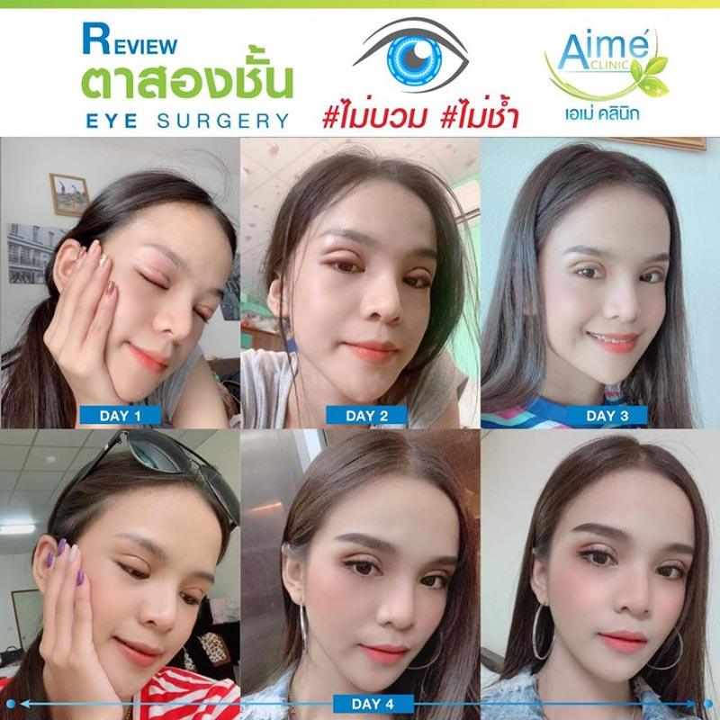 อาม ชุติมา