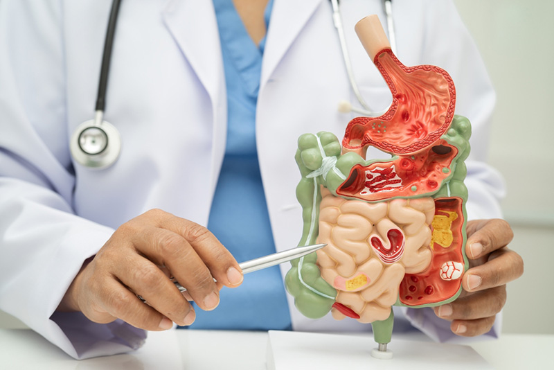 มะเร็งจิสต์ สาเหตุ